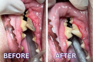 Before and After Dental Cleaning