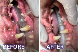 Before and After Dental Cleaning